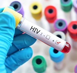 کشف سویه جدید HIV/ فیلم