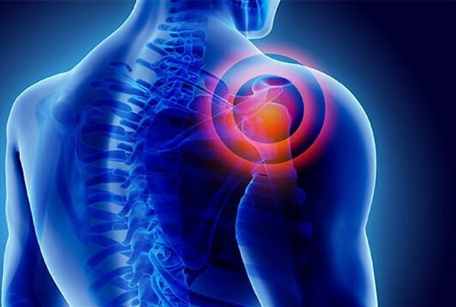 علت های شانه درد چیست؟