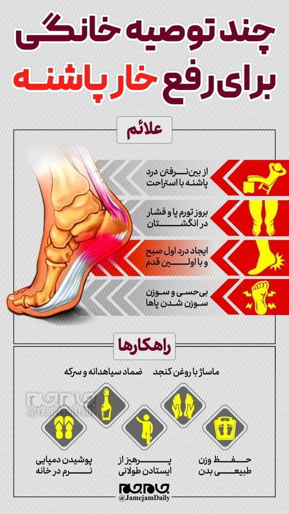 چند توصیه خانگی برای رفع خارپاشنه