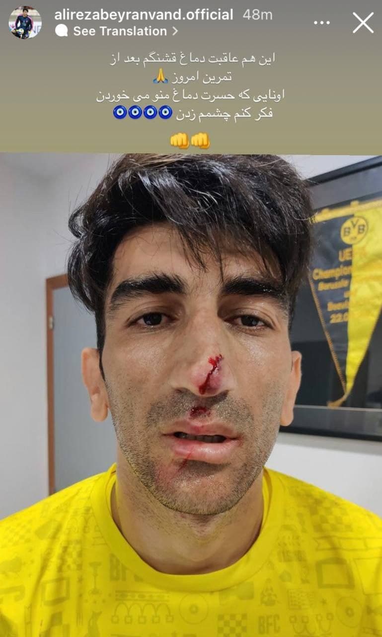 خونریزی بینی بیرانوند در تمرین + عکس