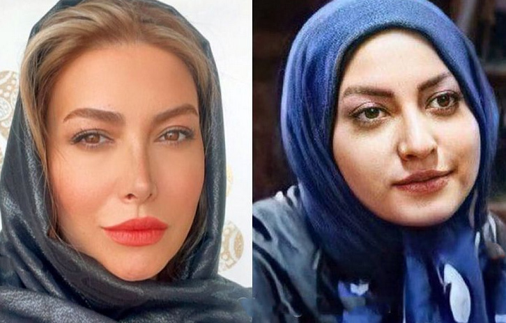 چهره متفاوت فریبا نادری قبل از عمل بینی + عکس چهره متفاوت فریبا نادری قبل از عمل بینی + عکس