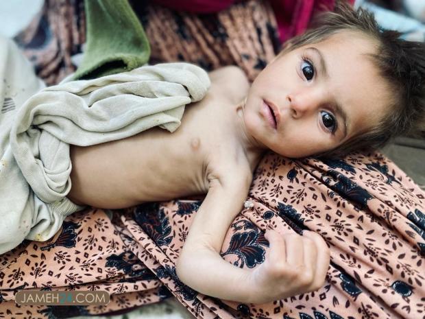 تصاویری غم بار از کودکان افغان