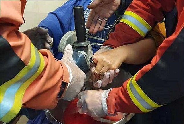 گوشت کوب برقی دست زن خانه دار را بلعید گوشت کوب برقی