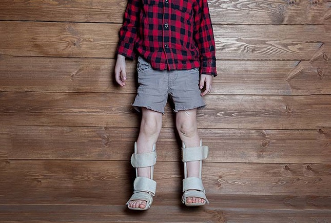 راشیتیسم و پوکی استخوان در کمین کودکان کم تحرک