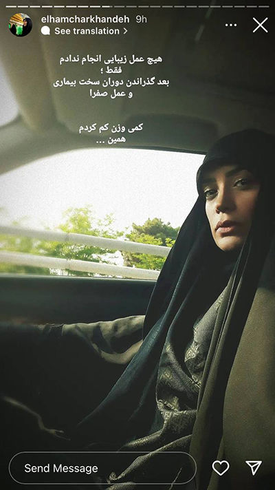 تغییر چهره الهام چرخنده