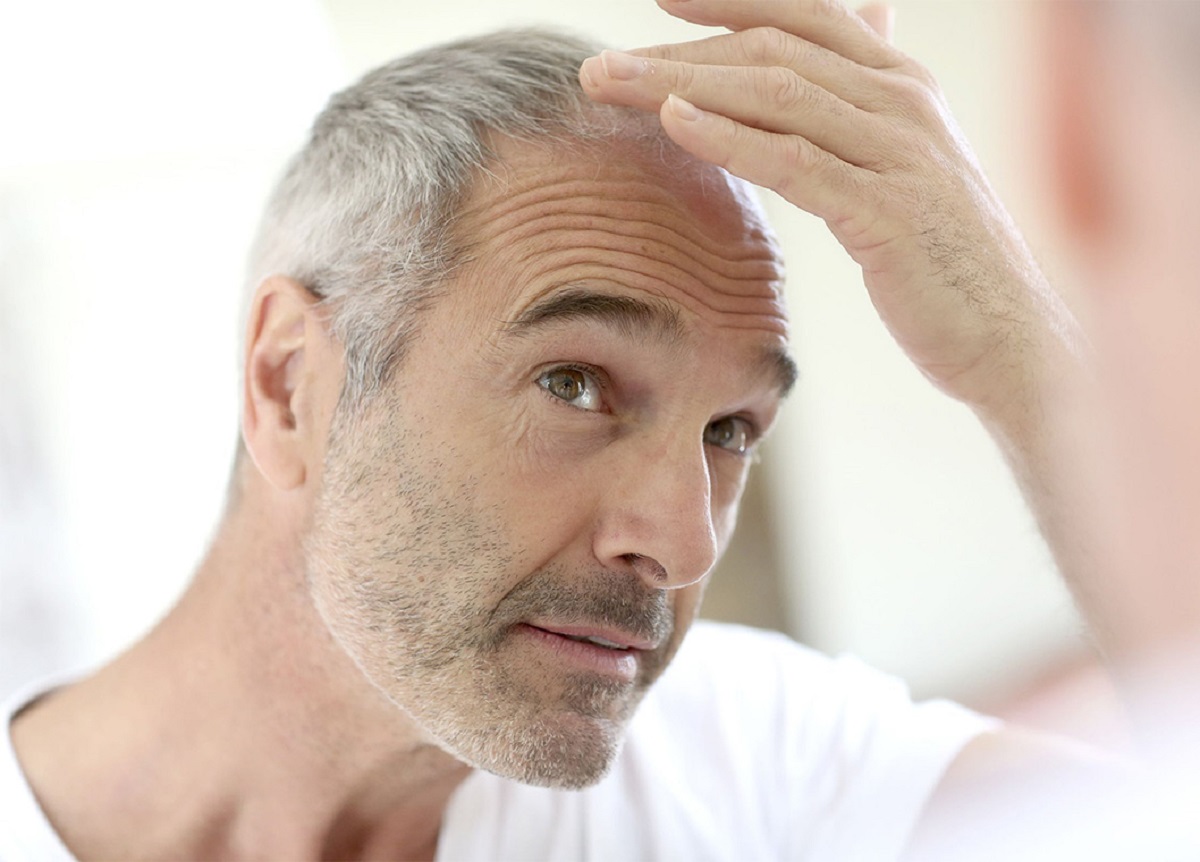 راه های جلوگیری از سفید شدن مو راه های جلوگیری از سفید شدن مو