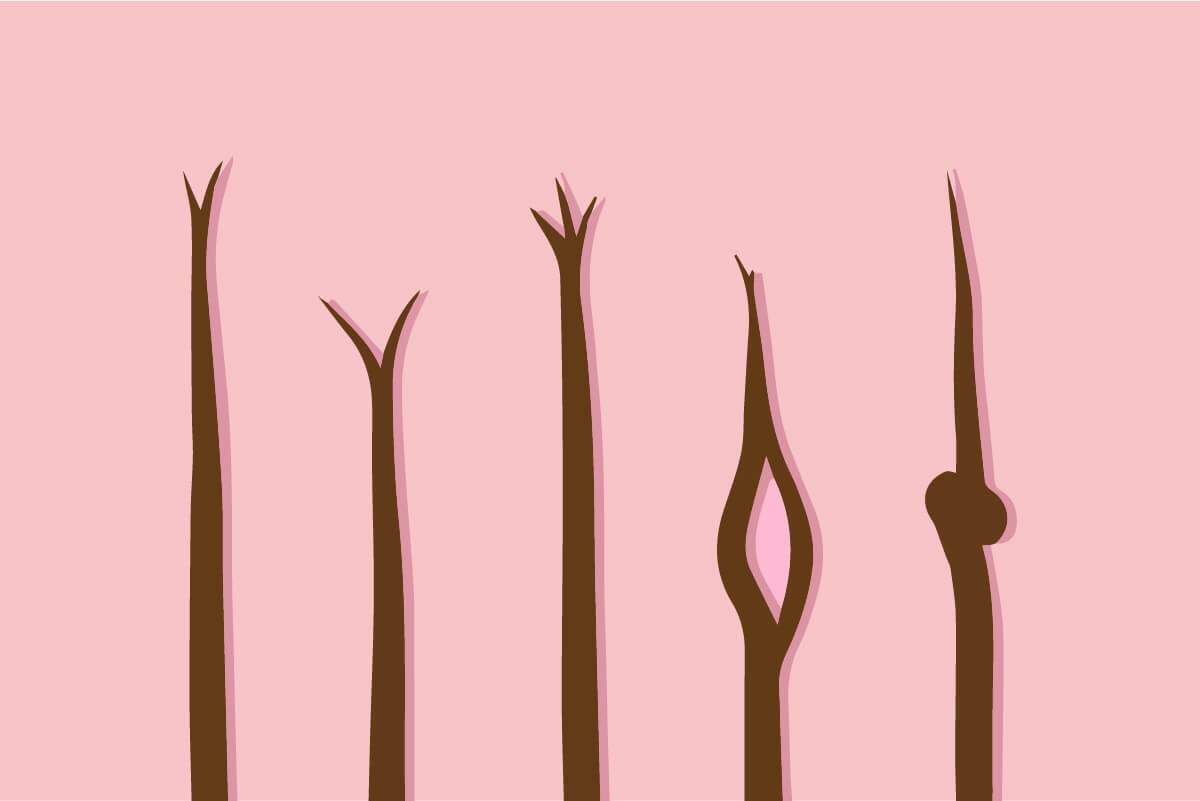 راههای درمان موخوره راههای درمان موخوره