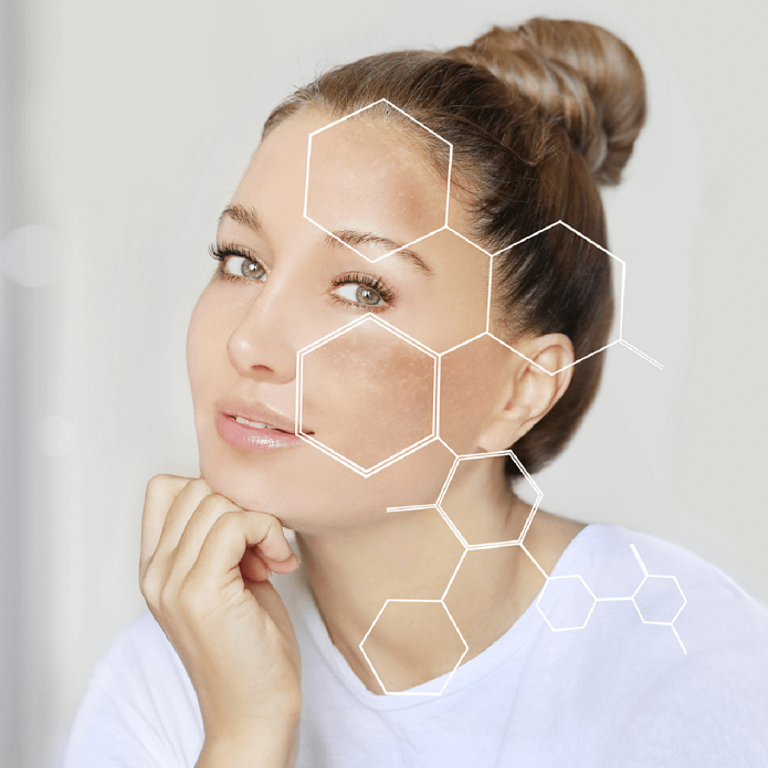 لک‌ های قهوه‌ ای صورت را چگونه از بین ببریم؟