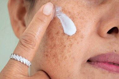 لکه‌های پوستی بارداری چرا ایجاد می‌شوند و چگونه از آنها پیشگیری کنیم؟