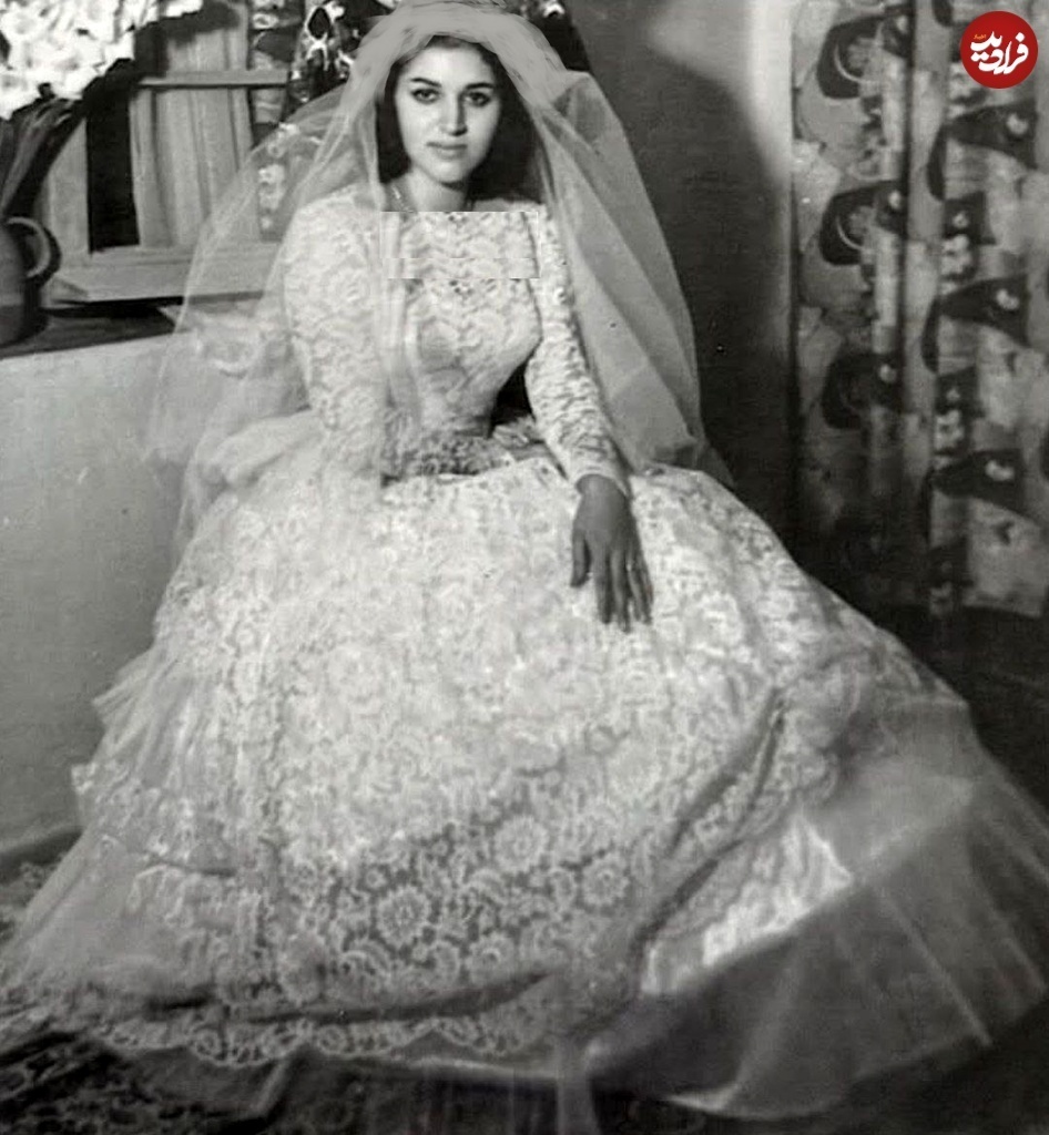 عکس عروسی مهستی قبل از عمل بینی