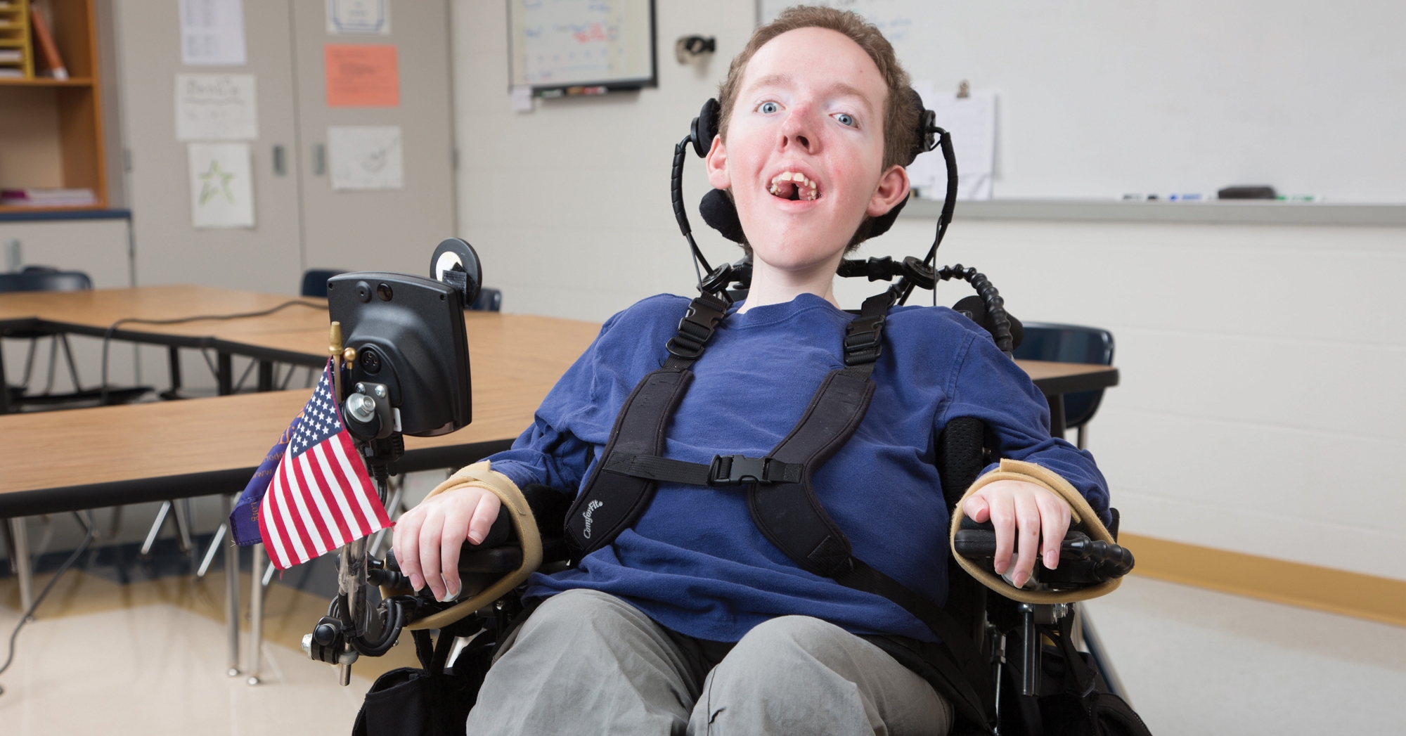 بیماری اس‌ ام اس چیست و راه‌های درمان آن کدامند؟