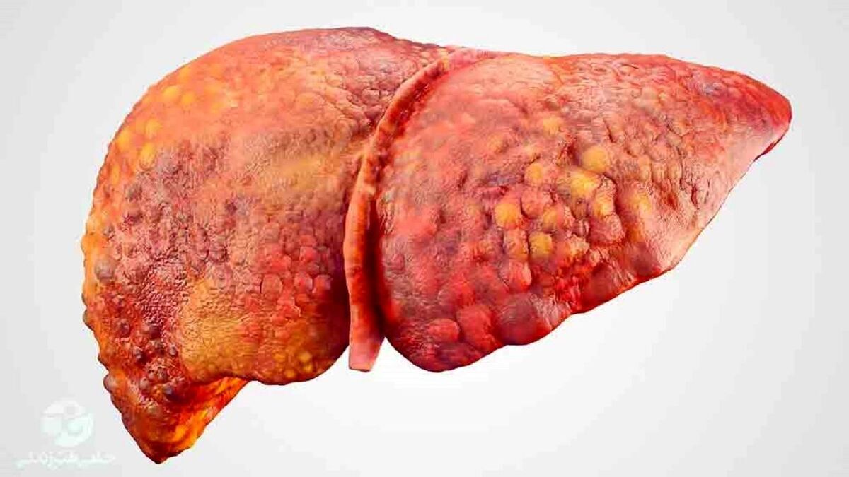 علائمی که نشان از مرگ زودهنگام میدهند علائمی که نشان از مرگ زودهنگام میدهند