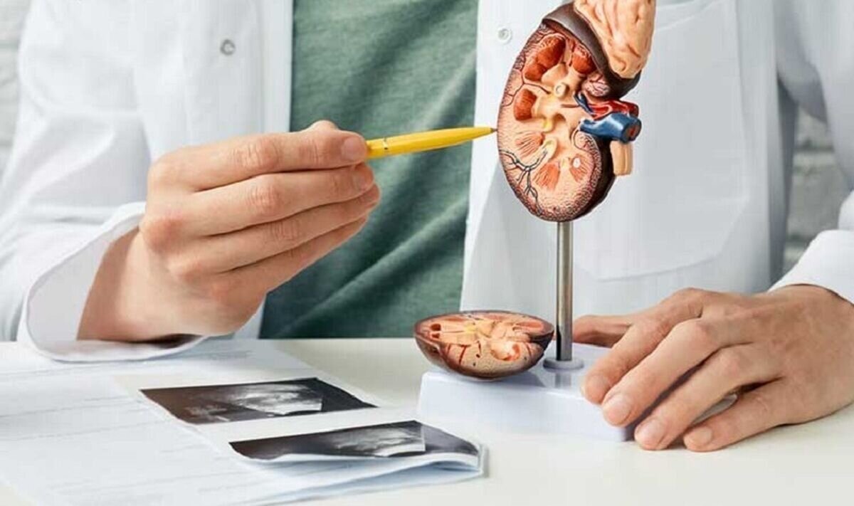 علائم و نشانههای سنگ کلیه چیست؟ علائم و نشانههای سنگ کلیه چیست؟