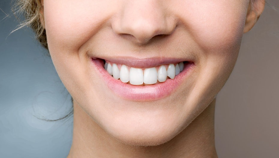 راه‌های سفید کردن دندان