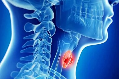چگونه متوجه شویم تیروئید کم‌کار یا پرکار داریم؟