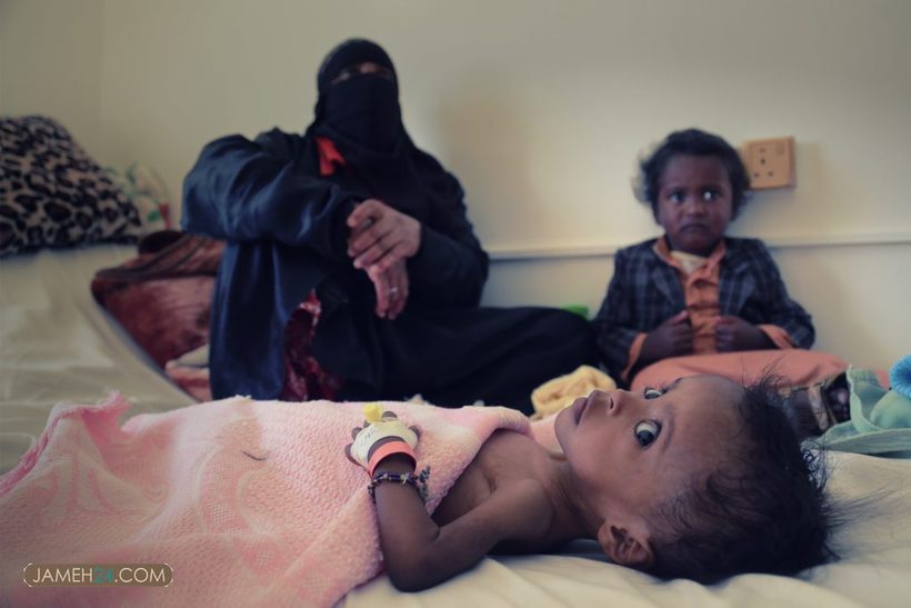 بحران انسانی در یمن